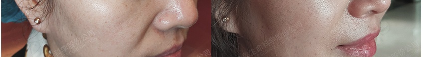 美容干細胞有副作用嗎_干細胞美容_美容細胞