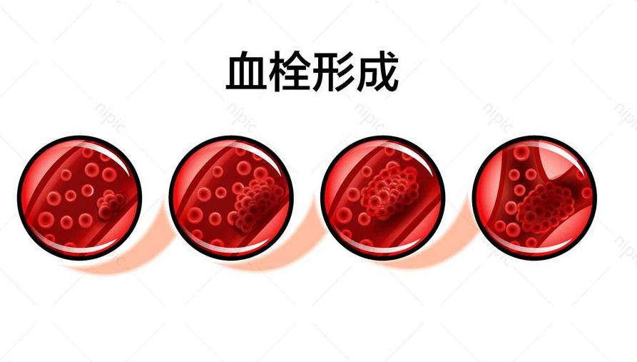 氨甲環(huán)酸能美白嗎_美白氨甲環(huán)酸注射怎么用_美白可以吃氨甲環(huán)酸片嗎