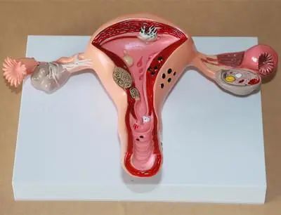 美容院子宮排毒有必要做嗎_美容院的子宮排毒一大坨是什么_子宮排毒有必要嗎