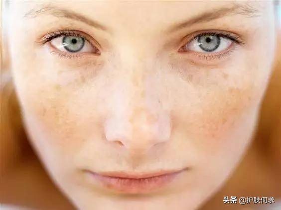 斑淡化最有效的方法_美白淡斑最簡單的方法_美白袪斑